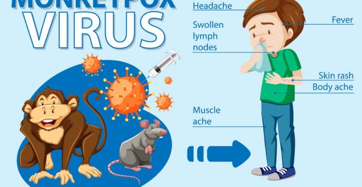 A man with monkeypox and the symptoms
