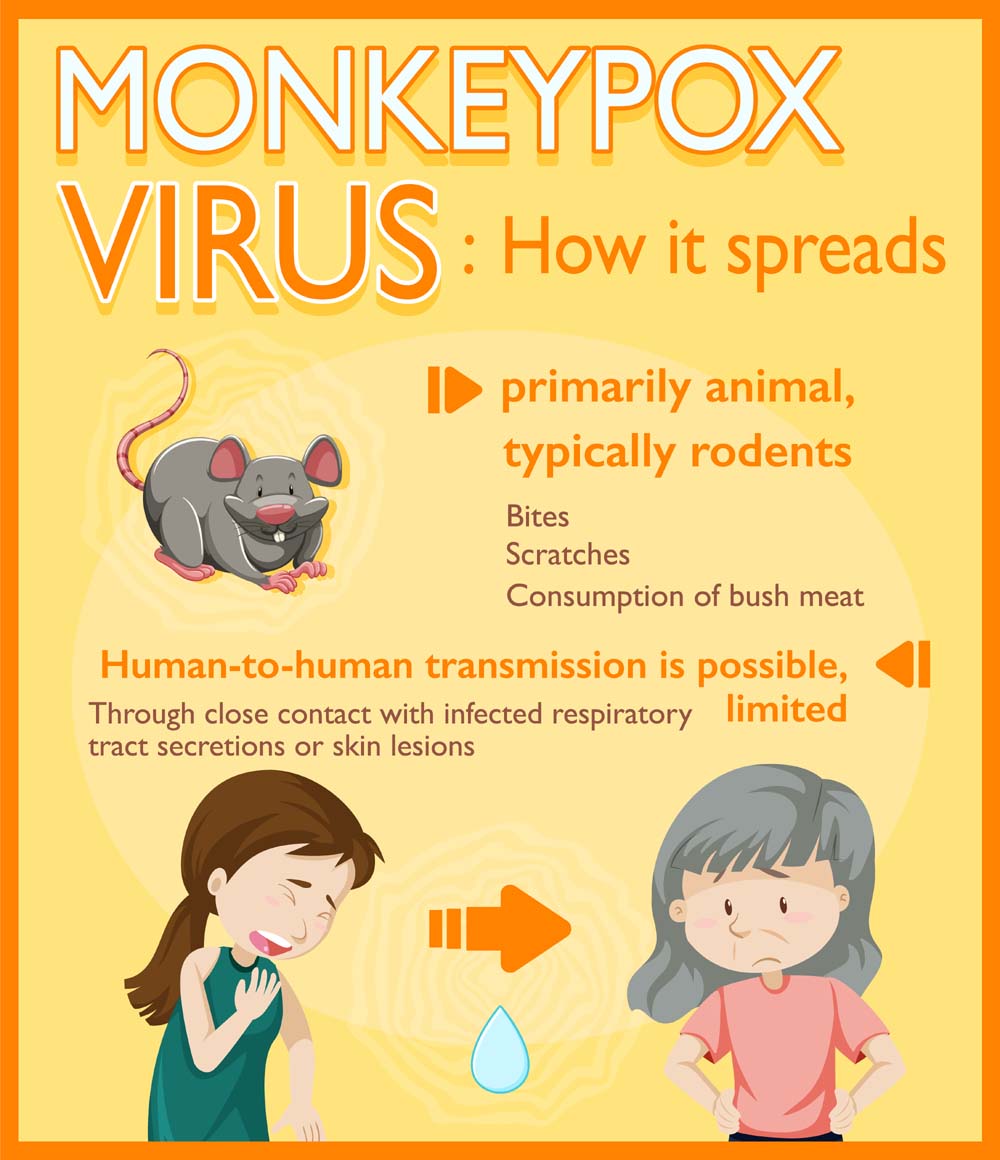 What is Monkeypox